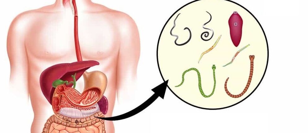 Paraziti v človeškem telesu