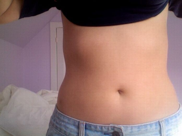 Rezultat zdravljenja s kapsulami NEOflorax