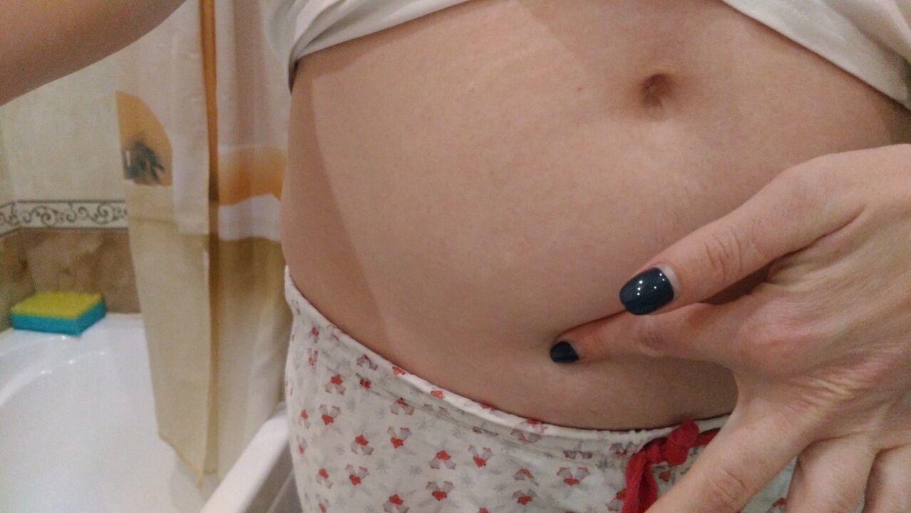 Znaki okužbe s helminti iz osebnih izkušenj