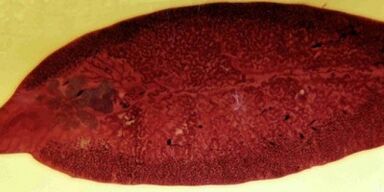 Parazit trematoda, kako odstraniti iz telesa