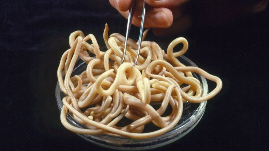 parazitov iz človeškega telesa